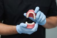 ленти за избелване на зъби - 72156 вида