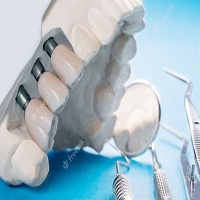 зъбни импланти - 56009 селекции
